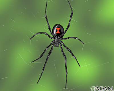 “The female black widow is easily recognized by her shiny black body and red hourglass marking underneath her round abdomen”MedLinePlus, a service of the U.S. National Library of Medicine and the National Institutes of Health
