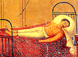 Close-up of Sabastiano Gunsolo, lying on a bed, suffering from smallpox clearly visible as red marks on his face, chest, arms, and feet, oil on tin. From the Chiesa dell'ospedale Santa Marta, (Church of the hospital of Saint Martha), Catania, Sicily. Courtesy Giuseppe Maimone Editore, Catania and Mario Alberghina.