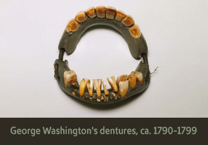 <a href='onlineactivities04.html'>4. George Washington’s dentures, ca. 1790–1799</a><h4>George Washington’s dentures, ca. 1790–1799</h4><h5><em>Courtesy Mount Vernon Ladies’ Association</em></h5><p>George Washington owned this full-set denture made with human and animal teeth, lead, brass wire, and steel springs.  Unlike real teeth, the bulky and ill-fitting dentures were often uncomfortable and painful, while eating and speaking.</p>