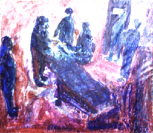 A red, black and white ink drawing of an operating room with a pediatric ophthalmologist and his assistants garbed in surgical gowns that are dark with the side lighting of the bulb and the lightning of the laser. A patient lies on the operating table receiving the laser treatment to prevent blindness