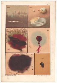 Bloodstain, blisters, bullet holes, 1864