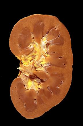 Normal Kidney crossection