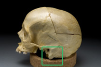 Skull 2