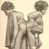 Nineteenth century profile drawing of Millie-Christine McCoy as adults.  They are dressed in period-style stockings and boots, and draped in cloths that cover their fronts, but reveal the conjoined area at their buttocks.  They also appear to be hunch-backed.   The twins are each looking to the side; one has her eyes closed.