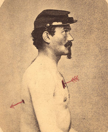 Man in profile, seated, shirtless, and wearing a military cap with an arrow showing the path of a bullet through the torso.