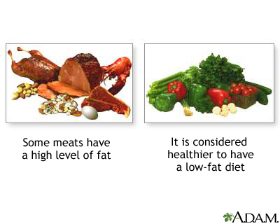 Healthy diet: MedlinePlus Medical Encyclopedia Image