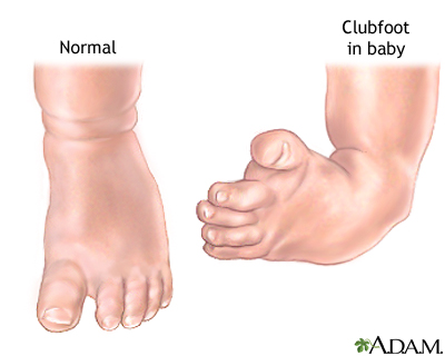 anatomy of foot. Normal anatomy