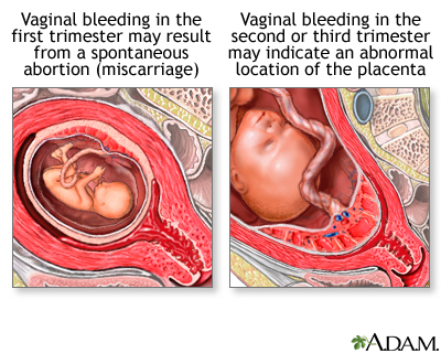 Click Here for bleeding during pregnancy