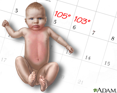 Child Health Care  on Roseola  Fever Alarm  I    Daily Health Care And Medical Tips