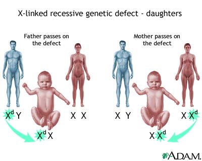 New software traces origins of genetic disorders 20 times more accurately