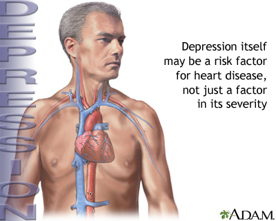 heart disease pictures. Depression and heart disease
