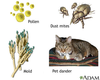  trigger asthma. Common allergens include pollen, dust mites, 