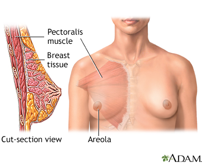 breast augmentation photos. Breast augmentation - series: