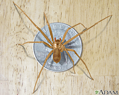 BROWN RECLUSE spider: MedlinePlus Medical Encyclopedia Image