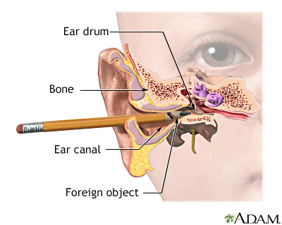 in ear