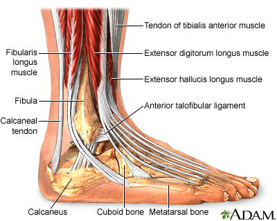 Steroid injection ankle arthritis