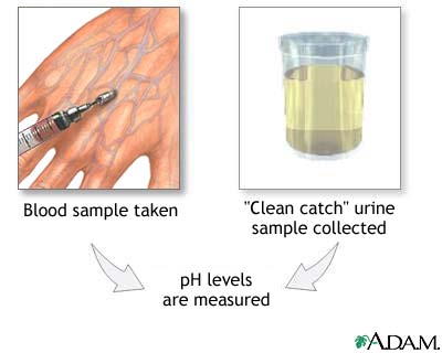 Ph Acidic In Urine Test