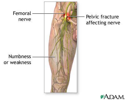 Nerve Damage In The Leg 66