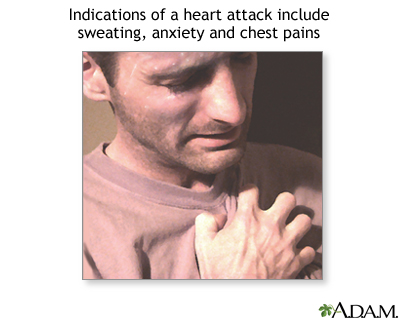 Heart Attack. Symptoms of heart attack