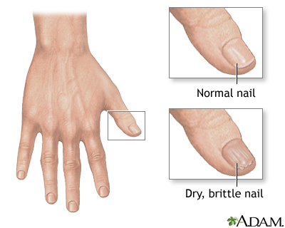 brittle nails stamp