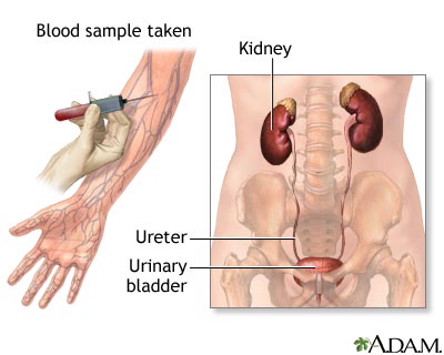 tests  kidney