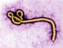 Foto del virus Ebola bajo el microscopio