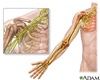 Ilustración del hombro y del brazo demostrando el plexo braquial