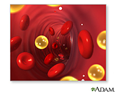Ilustración de colesterol en la sangre