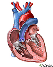 bicuspid aortic valve icon