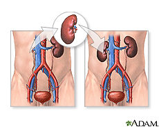 Steroid free kidney transplant