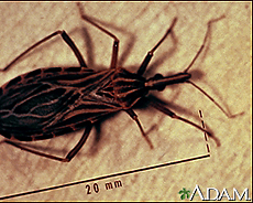 Chagas Disease Treatment Guidelines