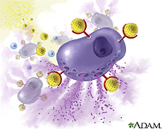Illustration of a mast cell releasing histamine