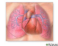 http://www.nlm.nih.gov/medlineplus/images/pulmonaryhypertension.jpg