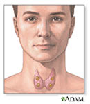 Ilustración de la tiroides y las glándulas paratiroides