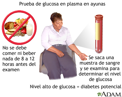 prediabetes causa y diagnostico