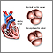 Histologicos de las valvulas cardiacas pdf tipos