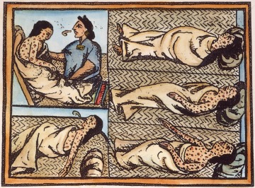 Drawing Showing Nahuas [Nahuatl] Infected with Smallpox Disease