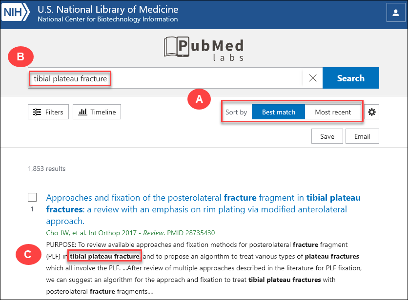 screenshot of PubMed Labs search results for tibial plateau fracture.