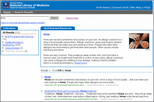 Screen capture of NLM site search results for hives.