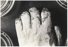 The tips of the fingers of the victims were cut off to prevent fingerprint identification, 1935