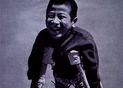 A smiling young boy wearing leg braces and using crutches.