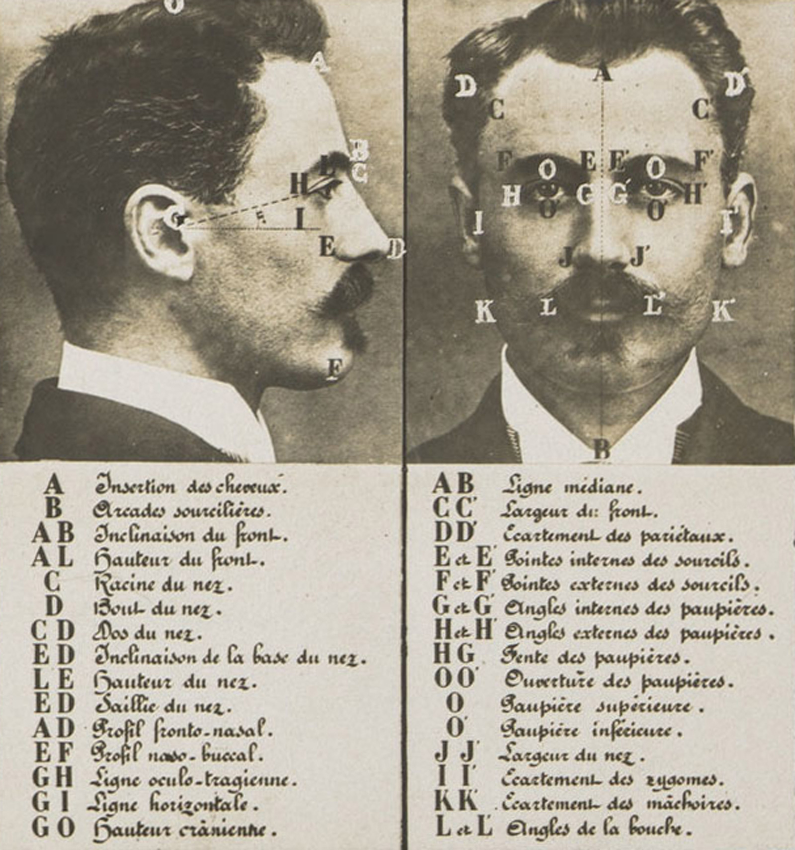 Diagram of a White man’s face and profile with letters pointing out various characteristics