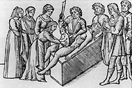 One of the earliest printed illustrations of Cesarean section. Purportedly the birth of Julius Caesar. A live infant being surgically removed from a dead woman. A cesarean section has been performed on a dead woman; to the left stand three men, to the right stand three women; a surgeon stands next to the body holding a razor, and a midwife extracts the baby. From Suetonius' Lives of the Twelve Caesars, 1506 woodcut. Image A023262 from Images from the History of Medicine