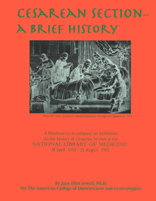 Cesarean Section - A Brief History home page
