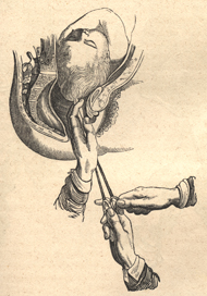 The side, interior view of the womb of a woman showing the upper body of a fetus, where a craniotomy is being performed. Two hands hold the handles of a crotchet whie a third hand guides the end of the crotchet to the top of the fetus' head.