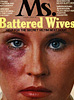 Woman with a black eye looks straight ahead at the viewer.