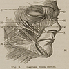 Full facial diagram image of the muscles of face drawn without skin, right side of the muscles of the face, from Darwin’s The expression of the emotions. Close-up image of the muscles around the eye and forehead, from Darwin’s The expression of the emotions.