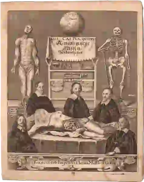 Three Dutch anatomists, wearing black clothes with white collars, pose sitting around a table which has on it a dissected cadaver.