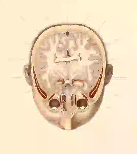 A colored cross-section of a person’s head, radiating lines lead to captions.