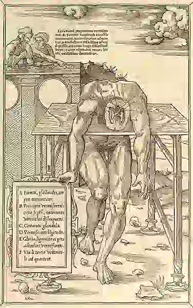Naked man draped over a table, with the top of his head sawed off, revealing a cross-section of his brain